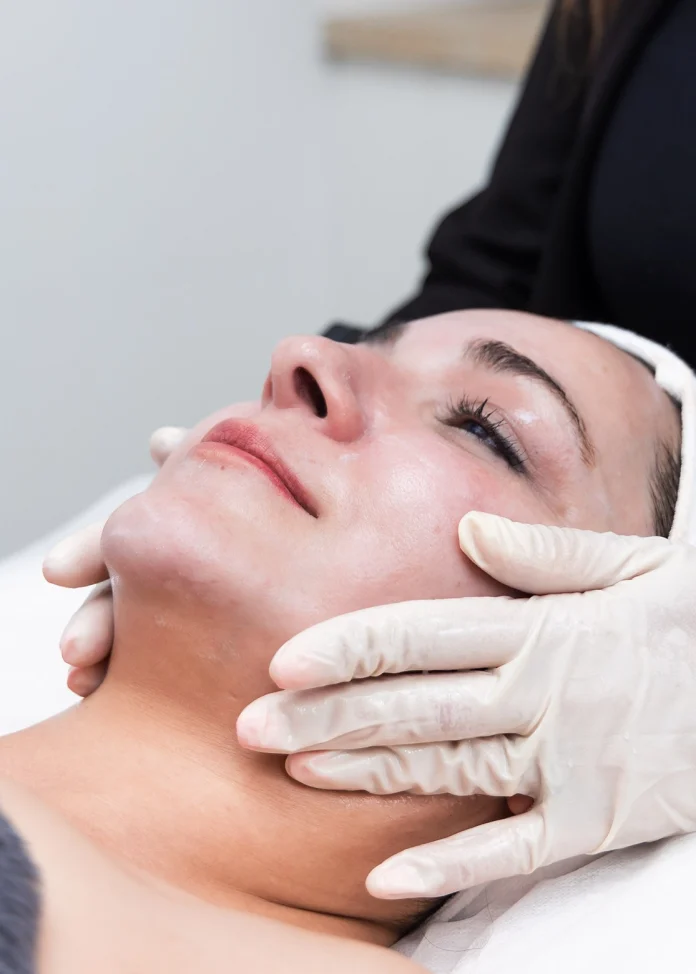 chemical peels perth